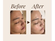 オージン スパ(OJIN SPA)の雰囲気（【ララピール正規取扱店】透明感のあるツヤ肌ピーリング☆）