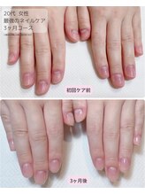 カピリナ(Ka Pilina)/自爪育成