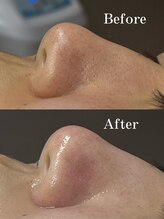 ティーツリー 名古屋 桜山(Tea Tree)/お久しぶりです