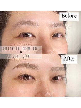 アンドミー(&me)/HBL ×ラッシュリフト