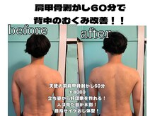 ルルマル(lulumalu)の雰囲気（天使の羽(60分)¥10000→¥8000猫背、背筋を良くしたい方必見です!）