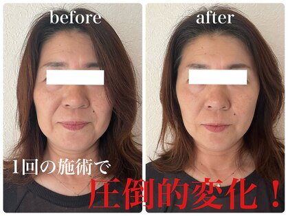 ジャスミン(Jasmine)の写真