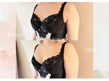 ルナ 千葉(LUNA)/1回施術後