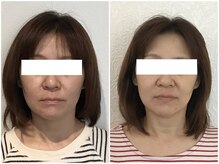 美容整体 ウェリナ 蟹江院/小顔矯正/骨盤矯正/美脚サロン 