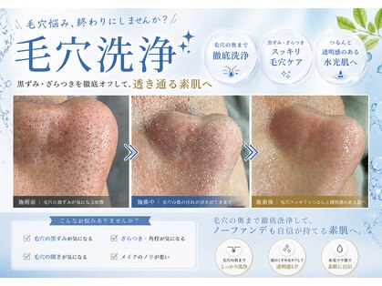 レベンディス(LEVENDIS)の写真