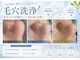 レベンディス(LEVENDIS)の写真
