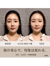 エレーニ 麻布十番(ELENI)/中顔面から立体小顔【麻布十番】