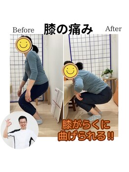 三条かがやき整体院/膝の痛み改善