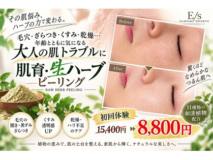 イーズ 武蔵小杉店の写真