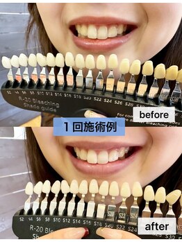 ガーディー(GaDaY)/やったもん勝ち♪♪