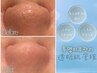 全顔ハイドラ毛穴洗浄60分60分5800円◆毛穴洗浄/毛穴汚れ/引き締め