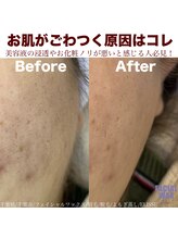 エリス(ELISSE)/お肌がごつく原因はコレ！