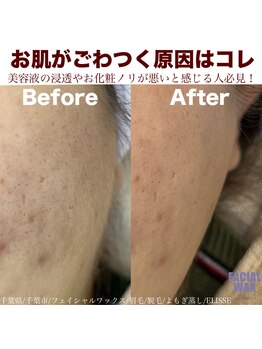 エリス(ELISSE)/お肌がごつく原因はコレ！