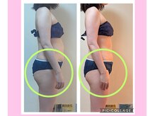 ヨサパーク コクリ(YOSA PARK kokuRi)/お尻も小尻に！