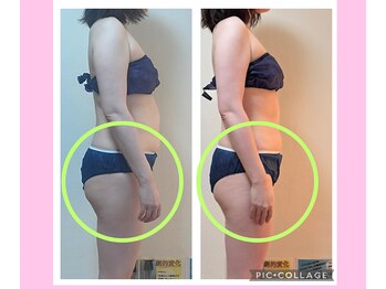 ヨサパーク コクリ(YOSA PARK kokuRi)/お尻も小尻に!