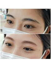 ビメ 中央林間(BEME)/before・after