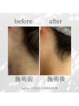 ココ シャルール(salon COCO CHALEUR)/Before　After