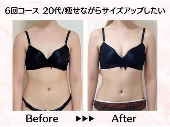 美人バスト リグラス(ReGrous)/バストアップbefore,after