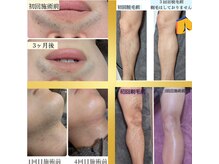 ミヤビ(MIYABI)の雰囲気（悩む時間は無駄ですよ！悩むなら一度体験でお越しください！）