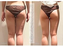 シューラディアント(ShuRadiant)/お悩み別に部分ケア！