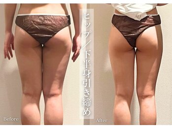 シューラディアント(ShuRadiant)/お悩み別に部分ケア！