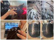 エルール トータルビューティ(Aileure total beauty)