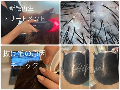 エルール トータルビューティ(Aileure total beauty)の写真