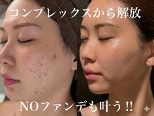 レイニゲン(H/Reinigen)