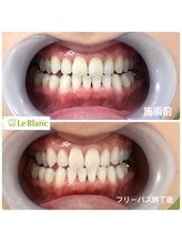 ルブラン 奈良店(Le Blanc)/この機会にぜひ！