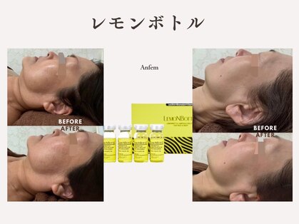 アンフェム(Anfem)の写真