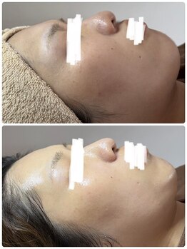 サロンニーナ(Salon.Nina)/韓国肌管理セルマン