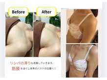 アール(R)の雰囲気（オールハンドマッサージによるバストアップケア。）