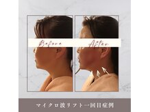 サロン ド シャーロット 恵比寿の雰囲気（韓国最新美容マイクロ波リフト☆痛み・タウンタイム無し小顔）