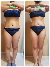 コハサロン(COHA SALON)/痩身メニュー7回のBefore→After