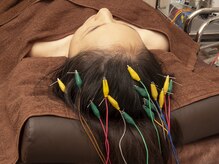 長寿鍼灸院 長寿整骨院/頭皮、育毛鍼灸です。