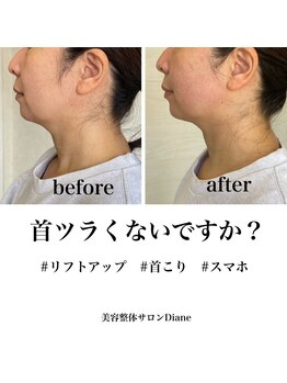 ディアンヌ(Diane)/肩コリ/首コリ/頭痛/小顔/猫背