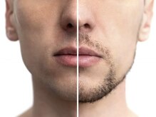 パリス 七尾店/男も脱毛習慣