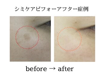 カピリナスパ(Ka.Pilina Spa)/before⇒after