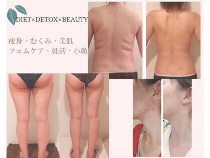 ヨサパーク ル フェルナ(YOSA PARK Le Ferna)の写真