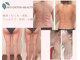ヨサパーク ル フェルナ(YOSA PARK Le Ferna)の写真