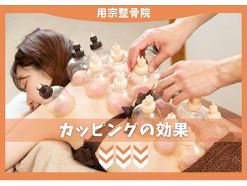 用宗整骨院/【カッピング】体の不調改善！
