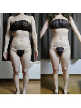 スリール(sourire)/ビフォーアフター