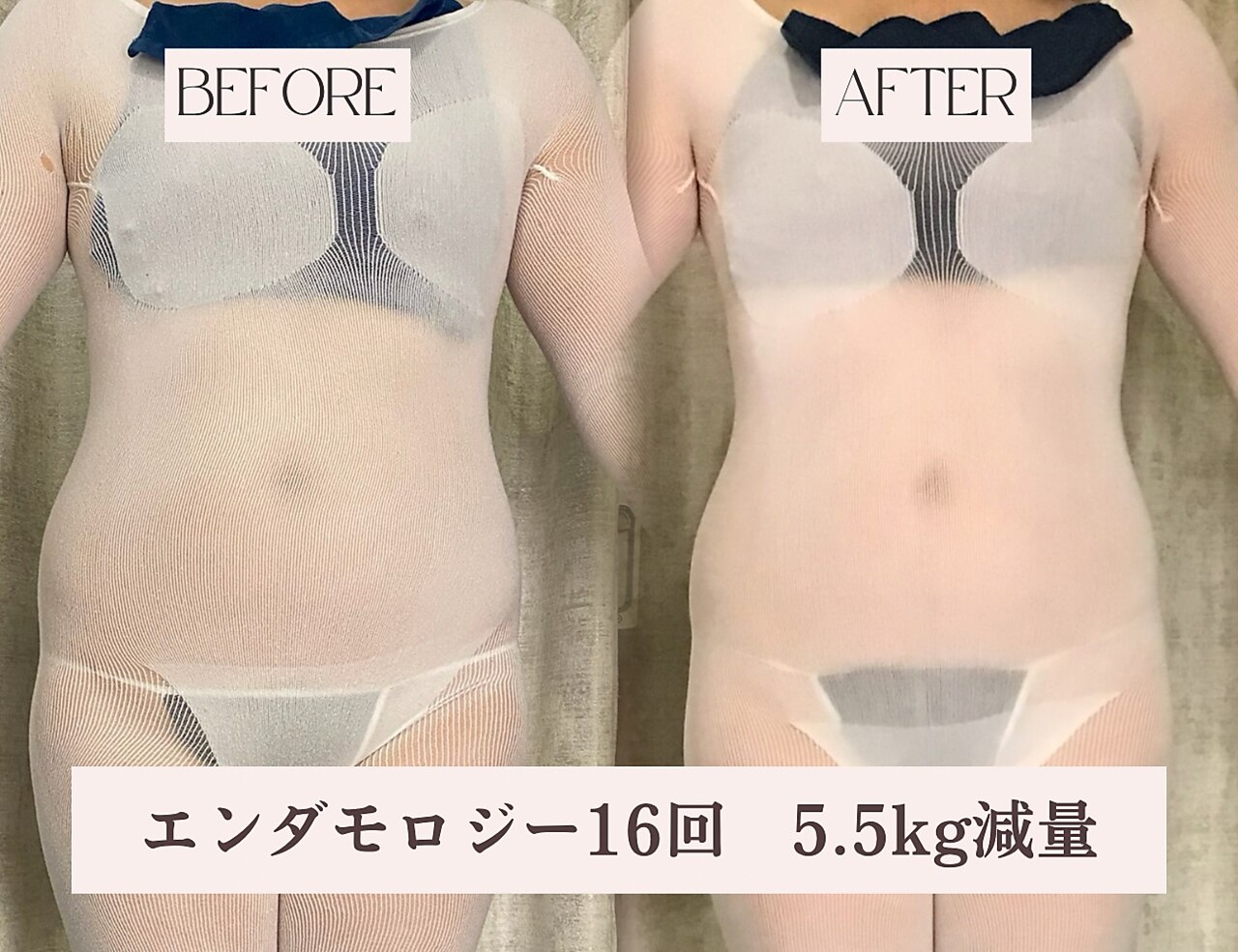 八王子市でエンダモロジーが人気のエステサロン｜ホットペッパー
