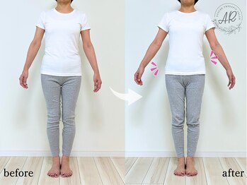 エーアール(AR)/【Before/After】