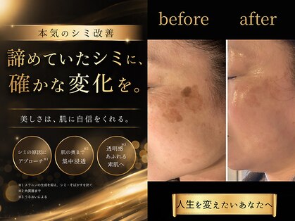 マイルーチェ 可児川合店(MyLuce)の写真