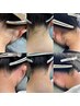 【2ヶ月以内再来】うなじW脱毛|モニター枠|より洗練された首筋に