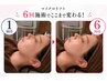 【横顔すっきり】首元までしっかり|マイクロウェーブ全顔+顎下+首元120kj
