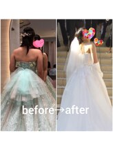 ヘルス＆ビューティークリニック　住美香（すみか）/ブライダルエステで背中も美人！