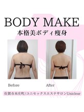 ユニクリア(Uni clear)/ダイエット◆痩身エステ