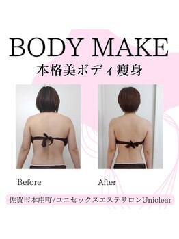 ユニクリア(Uni clear)/ダイエット◆痩身エステ